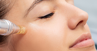 Formation microneedling